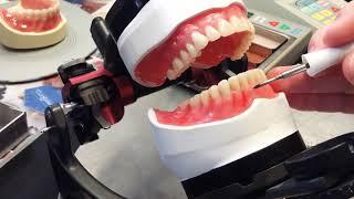 Characterized Denture Wax Up