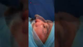 Rhinoplasty | Nose Reshaping Surgery | Dr. Vikas Gawri | Kyra Aesthetic Clinic, Ludhiana Punjab