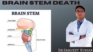 Tutorial  81 -- BRAIN STEM DEATH