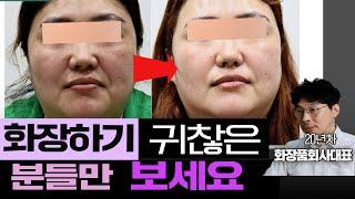 화장할 필요없이 기미 잡티 싹 다 없애는 방법/시술이나 비타민c로 색소관리하면 더 생기는 이유