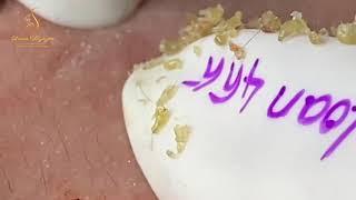 Satisfying With Loan Nguyen Spa Video #045