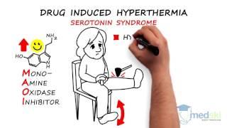 Emergency Medicine - Hyperthermia: By Anjali Hulbanni M.D. and Mudassir Khan M.D.