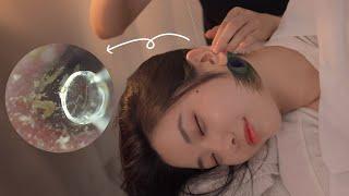 ASMR 보면서 받는 귀청소 | 내시경 구름칼 공작털 솜털 | Visual Ear Cleaning asmr