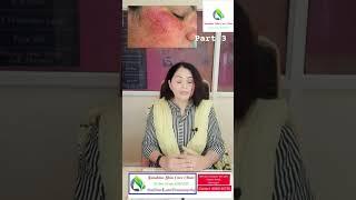 वांग/hyperpigmentation #skincare #doctor #ponds #garnier #skin #viral #trending #ytshorts #youtube