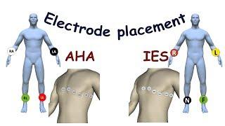 Electrode placement