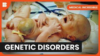 Defying Odds: Baby's Survival Story - Medical Incredible - Documentary