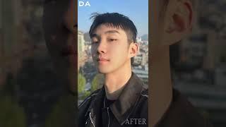 【韩国整形】DA before&after_轮廓案例分享