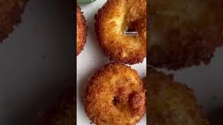 Cheese Burst Aloo donuts 