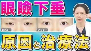 【目の開き】眼瞼下垂の原因と治療法を徹底解説