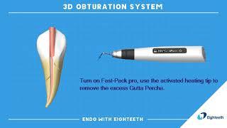 How to Use Eighteeth Obturation System Fast-Pack Fast-Fill Continuous Wave Compaction WVC