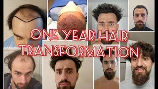 Cossacossa HAIR TRANSFORMATION