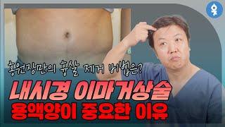 내시경 이마거상술 용액양이 중요한 이유