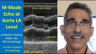 M-Mode Echo at Aorta LA Level