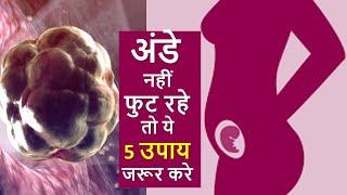 अंडे नहीं फुट रहे तो ये 5 उपाय करना न भूले ? 5 Super tips to Boost ovulation| In Hindi