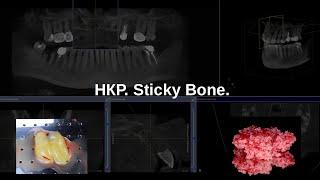 НКР. Sticky Bone.