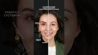 #dentist #стоматология #виниры