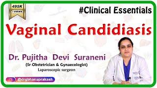 Vaginal Candidiasis (Clinical essentials): Dr. Pujitha Devi suraneni