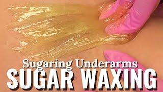 SUGARING UNDERARMS | SUGAR WAX #waxing #sugaring #hairremoval #sugarwax