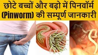 बढ़ो और बच्चों में पिनवॉर्म (Pinworm) की सम्पूर्ण जानकारी: लक्षण, इलाज (दवा), और बचाव के तरीके