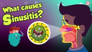 What Causes Sinusitis? | Sinus Infection | Dr Binocs Show | Peekaboo Kidz