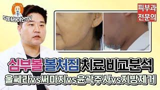 심부볼 볼처짐 울쎄라리프팅vs써마지vs윤곽주사vs지방제거 어떤게 좋을까 (효과 비교 심층 분석)