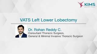 VATS Left Lower Lobectomy | Insidious Dry Cough | Video-assisted Thoracic Surgery | KIMS Hospitals