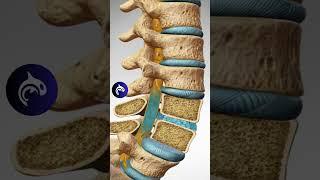 See how Spondylolisthesis affects the Spine in 3D Animation