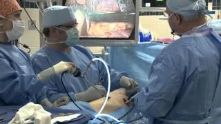 Managing Blood Loss in Thoracic Surgery