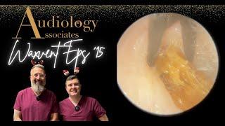 DEEP EAR WAX PLUG REMOVAL - WAXVENT 15