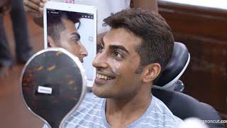 Face Makeover Surgery for a Man | Amazing Results After Plastic Surgery