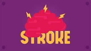 What is Stroke?