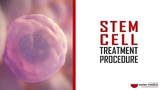 Stem Cell Treatment Procedure