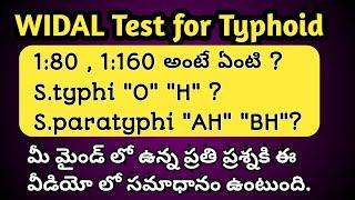 How to read Typhoid Widal Blood Test Report in Telugu