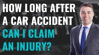 How long after a car accident can I claim an injury? | Personal Injury with Attorney Andrew Plagge