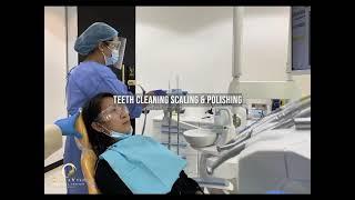 Dental teeth cleaning scaling and polishing