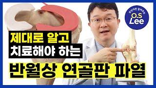 ⁉이 증상이 있다면 정형외과에 방문하시기 바랍니다[2편] I 반월상 연골판 파열