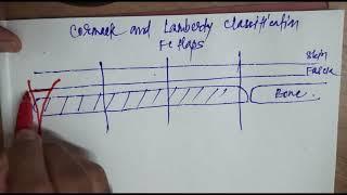 Fasciocutaneous Flaps: Cormack & Lamberty Classification( Easy)