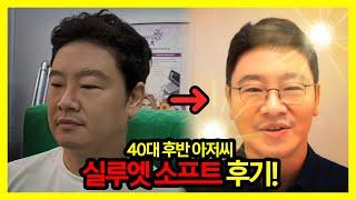 40대 후반 남자가 10살 어려지는 실루엣소프트 리얼 후기 [팔자주름 주름개선 처짐개선 동안 안티에이징]