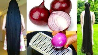 how to use Onion Juice For Extreme Hairfall /Hair loss /Dandruff|NickBeautyCorner