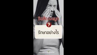 ริดสีดวงจมูก รักษาอย่างไร?