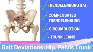 Gait Deviations: Hip, Pelvis, Trunk