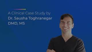 Clinical Case Study: Guided Tissue Regeneration Between a Natural Tooth and an Implant