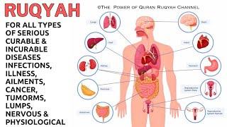 Ruqyah for all Types of Serious Curable&Incurable Diseases,Infections, Illness,Cancer,Tumorms&Lumps