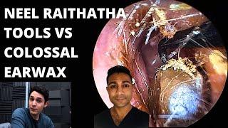 The Neel Raithatha Tools VS Colossal Earwax Blockage (First Impressions)