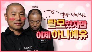 탈모였지만 이제 아니예유 (그레이시티 두피문신)