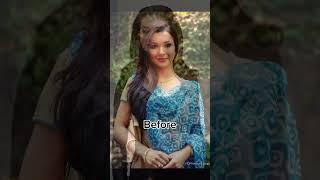 Amy Jackson before and after surgery#shortsvideo #explore #viral