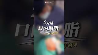 手術直擊！口內取脂竟只要2分鐘?!瘦小臉的加分術式 #嘴邊肉 #嬰兒肥 #脂肪墊 #荊偉政醫師