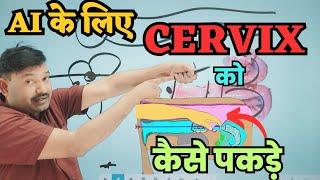 AI के लिए सर्विक्स ऐसे पकड़ें AI Gun Pass karne ka tarika / Cervix ko kaise Pakde