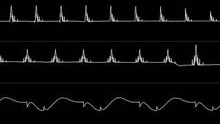 Martin Galway - “Wizball (C64) - Title Theme” (Real SID) [Oscilloscope View]