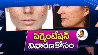 Best Home Remedies for Hyperpigmentation | Vanitha Tips | Vanitha TV